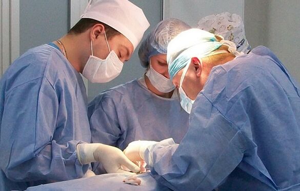 хируршко лечење варикозних вена